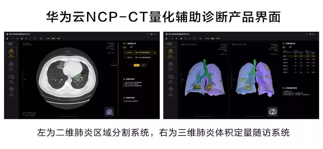 计算机视觉与医学影像分析技术