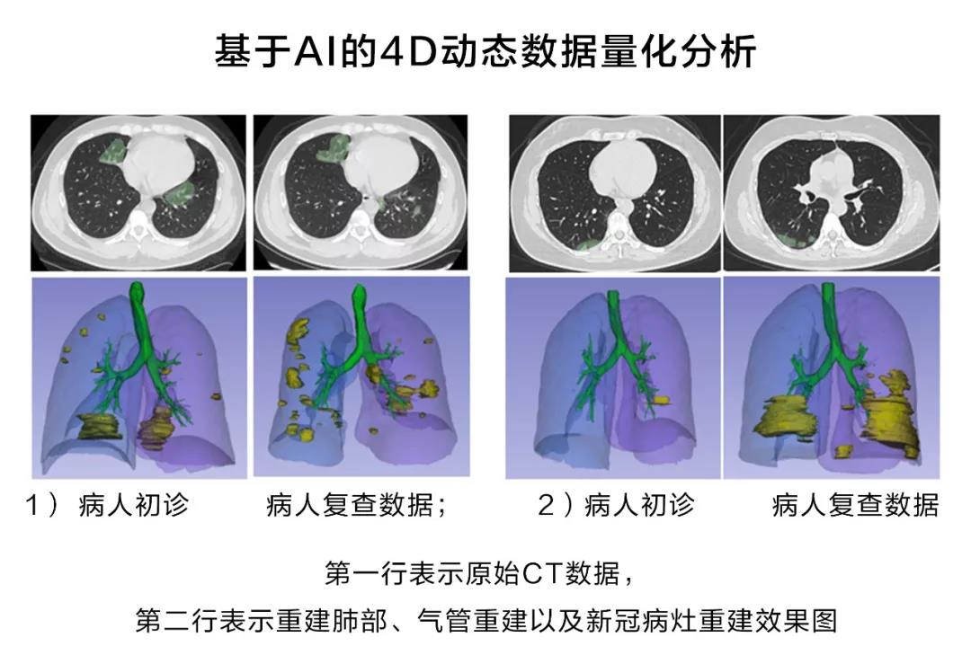 华为云医疗智能体-医学影像分析平台